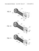 Intramedullary Nail and Protruding Screw Locking Mechanism diagram and image