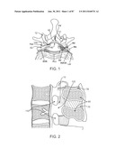 DEVICES AND METHODS FOR TISSUE ACCESS diagram and image