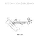 DEVICES AND METHODS FOR TISSUE ACCESS diagram and image