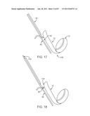 DEVICES AND METHODS FOR TISSUE ACCESS diagram and image