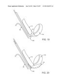 DEVICES AND METHODS FOR TISSUE ACCESS diagram and image