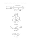 DEVICES AND METHODS FOR TISSUE ACCESS diagram and image