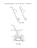 DEVICES AND METHODS FOR TISSUE ACCESS diagram and image