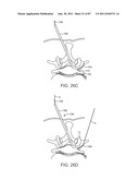 DEVICES AND METHODS FOR TISSUE ACCESS diagram and image