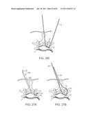 DEVICES AND METHODS FOR TISSUE ACCESS diagram and image