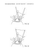 DEVICES AND METHODS FOR TISSUE ACCESS diagram and image