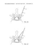 DEVICES AND METHODS FOR TISSUE ACCESS diagram and image