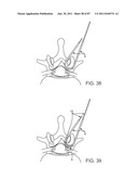 DEVICES AND METHODS FOR TISSUE ACCESS diagram and image