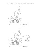 DEVICES AND METHODS FOR TISSUE ACCESS diagram and image