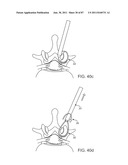 DEVICES AND METHODS FOR TISSUE ACCESS diagram and image