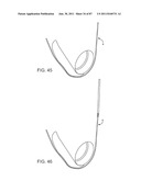 DEVICES AND METHODS FOR TISSUE ACCESS diagram and image