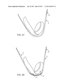 DEVICES AND METHODS FOR TISSUE ACCESS diagram and image