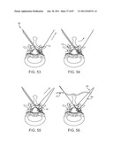 DEVICES AND METHODS FOR TISSUE ACCESS diagram and image