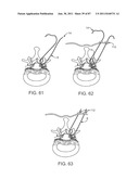 DEVICES AND METHODS FOR TISSUE ACCESS diagram and image