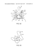 DEVICES AND METHODS FOR TISSUE ACCESS diagram and image