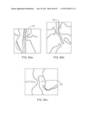 DEVICES AND METHODS FOR TISSUE ACCESS diagram and image