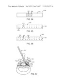 DEVICES AND METHODS FOR TISSUE ACCESS diagram and image