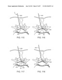 DEVICES AND METHODS FOR TISSUE ACCESS diagram and image