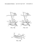 DEVICES AND METHODS FOR TISSUE ACCESS diagram and image