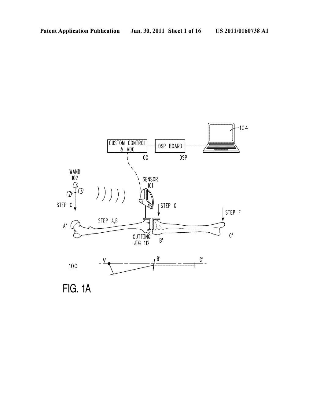 OPERATING ROOM SURGICAL FIELD DEVICE AND METHOD THEREFORE - diagram, schematic, and image 02