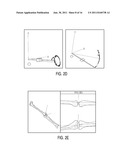 OPERATING ROOM SURGICAL FIELD DEVICE AND METHOD THEREFORE diagram and image