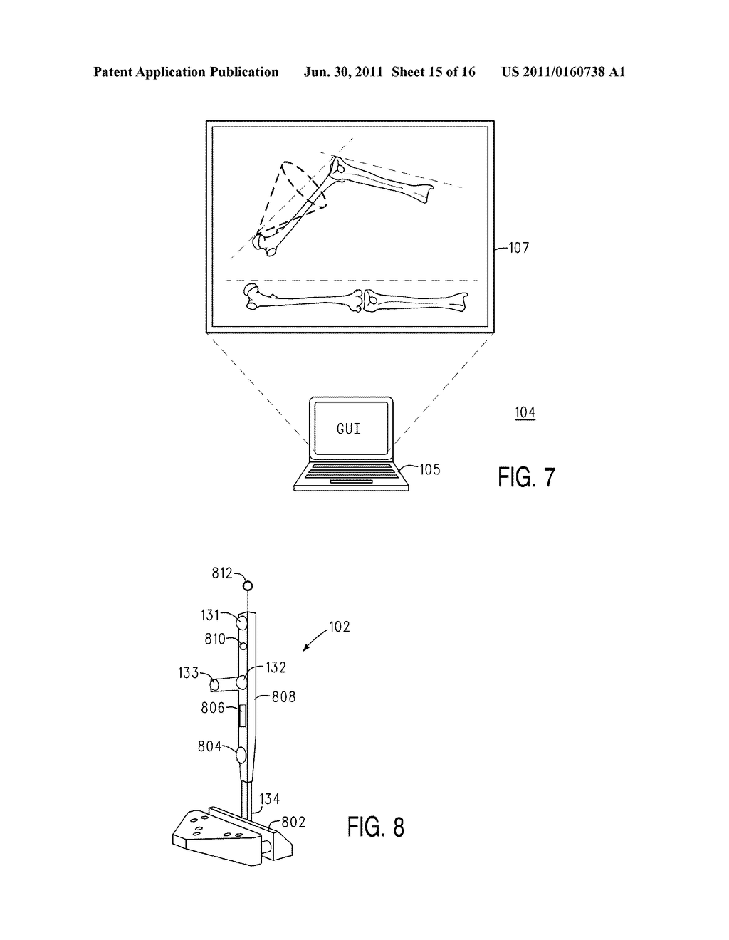 OPERATING ROOM SURGICAL FIELD DEVICE AND METHOD THEREFORE - diagram, schematic, and image 16