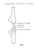 OPERATING ROOM SURGICAL FIELD DEVICE AND METHOD THEREFORE diagram and image