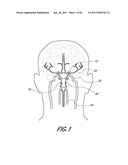 METHOD FOR PROVIDING PROGRESSIVE THERAPY FOR THROMBUS MANAGEMENT diagram and image