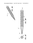 METHOD FOR PROVIDING PROGRESSIVE THERAPY FOR THROMBUS MANAGEMENT diagram and image