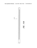 METHOD FOR PROVIDING PROGRESSIVE THERAPY FOR THROMBUS MANAGEMENT diagram and image