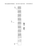 METHOD FOR PROVIDING PROGRESSIVE THERAPY FOR THROMBUS MANAGEMENT diagram and image