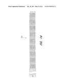 METHOD FOR PROVIDING PROGRESSIVE THERAPY FOR THROMBUS MANAGEMENT diagram and image