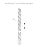 METHOD FOR PROVIDING PROGRESSIVE THERAPY FOR THROMBUS MANAGEMENT diagram and image