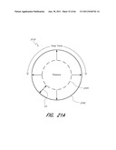 METHOD FOR PROVIDING PROGRESSIVE THERAPY FOR THROMBUS MANAGEMENT diagram and image