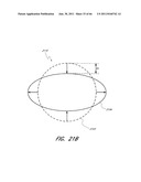 METHOD FOR PROVIDING PROGRESSIVE THERAPY FOR THROMBUS MANAGEMENT diagram and image