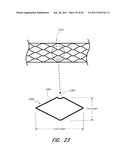 METHOD FOR PROVIDING PROGRESSIVE THERAPY FOR THROMBUS MANAGEMENT diagram and image