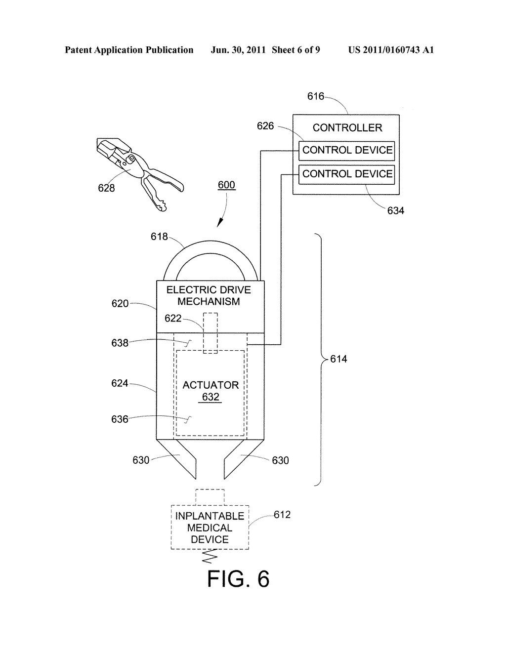 APPARATUS FOR MANIPULATION OF IMPLANTABLE MEDICAL DEVICE AND ASSOCIATED     METHOD - diagram, schematic, and image 07