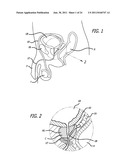 Continuous Indentation Lateral Lobe Apparatus and Method diagram and image