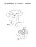 Continuous Indentation Lateral Lobe Apparatus and Method diagram and image