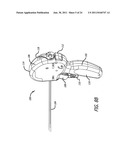 Continuous Indentation Lateral Lobe Apparatus and Method diagram and image