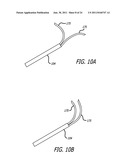 Continuous Indentation Lateral Lobe Apparatus and Method diagram and image