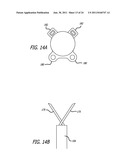 Continuous Indentation Lateral Lobe Apparatus and Method diagram and image