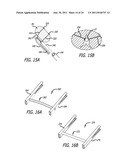 Continuous Indentation Lateral Lobe Apparatus and Method diagram and image