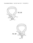 Continuous Indentation Lateral Lobe Apparatus and Method diagram and image