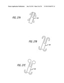 Continuous Indentation Lateral Lobe Apparatus and Method diagram and image