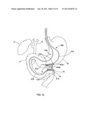 ELONGATE MAGNET FOR A MAGNETIC ANASTOMOSIS DEVICE diagram and image