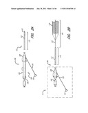 SYSTEM FOR PROVIDING PROGRESSIVE THERAPY FOR THROMBUS MANAGEMENT diagram and image