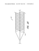 SYSTEM FOR PROVIDING PROGRESSIVE THERAPY FOR THROMBUS MANAGEMENT diagram and image