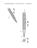 SYSTEM FOR PROVIDING PROGRESSIVE THERAPY FOR THROMBUS MANAGEMENT diagram and image