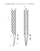 SYSTEM FOR PROVIDING PROGRESSIVE THERAPY FOR THROMBUS MANAGEMENT diagram and image